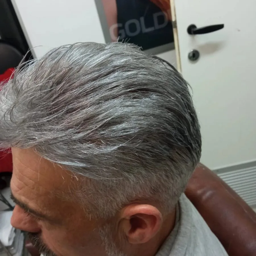 Capelli grigi dopo la protesi capillare
