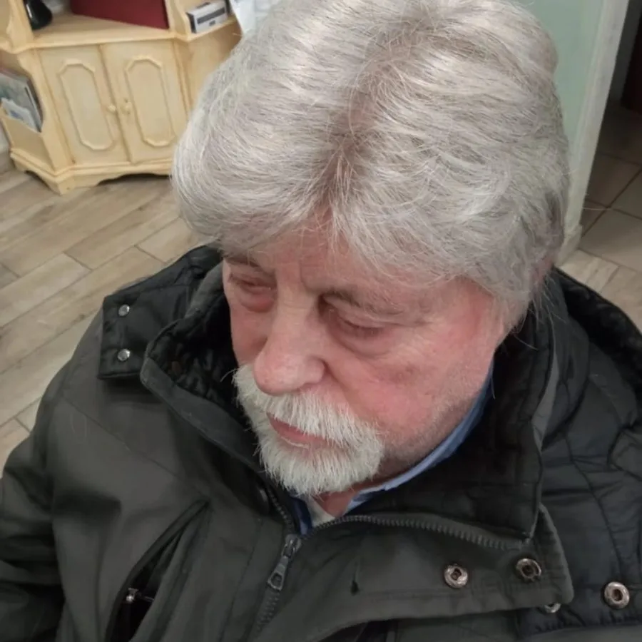 Capelli bianchi dopo la protesi capillare